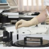 Počelo besplatno savetovanje i testiranje na HIV u Subotici 1