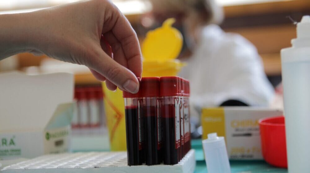 Skoro 40 odsto obolelih od multipli mijeloma čini radno sposobno stanovništvo 1