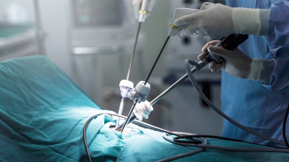 Prva laparoskopska operacije karcinoma želuca u Leskovcu u nedelju 1