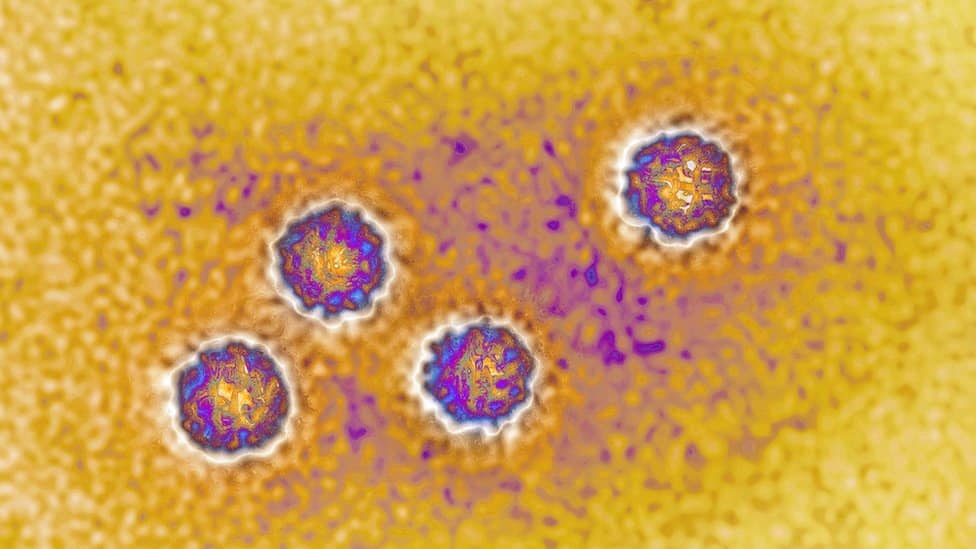 Virus hepatitisa A