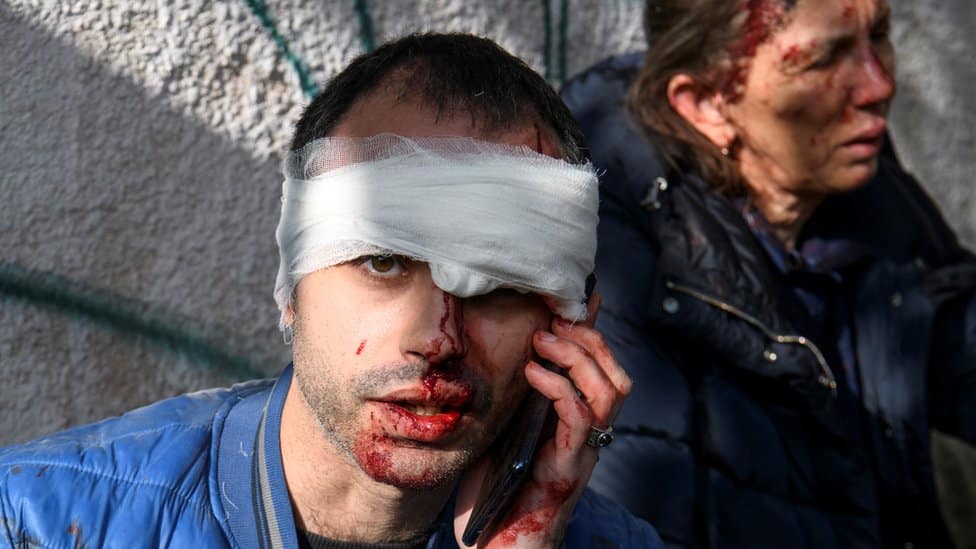 Rusija i Ukrajina: Moskva tvrdi da gađa vojnu i energetsku infrastrukturu i negira ratne zločine 3 Napad na Kijev