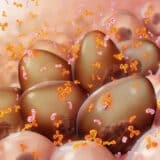 Održan kongres hematologa u NS: U Srbiji se svake godine registruje oko 526 novih pacijenata sa multipli mijelomom 7