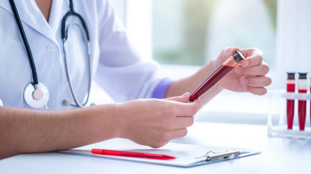 Institut za transfuziju apelovao na donore krvi, najviše nedostaju A i nulta krvna grupa 1