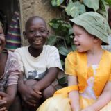 Jeziva sudbina albino crnaca: Bogataši veruju da im njihovi delovi tela mogu doneti novac i moć 11