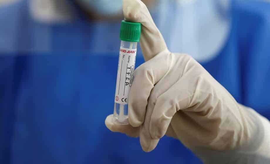 Epidemija žutice zvanično i u Kotoru: Zaraza u Boki krenula iz restorana? 1