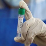 Epidemija žutice zvanično i u Kotoru: Zaraza u Boki krenula iz restorana? 3