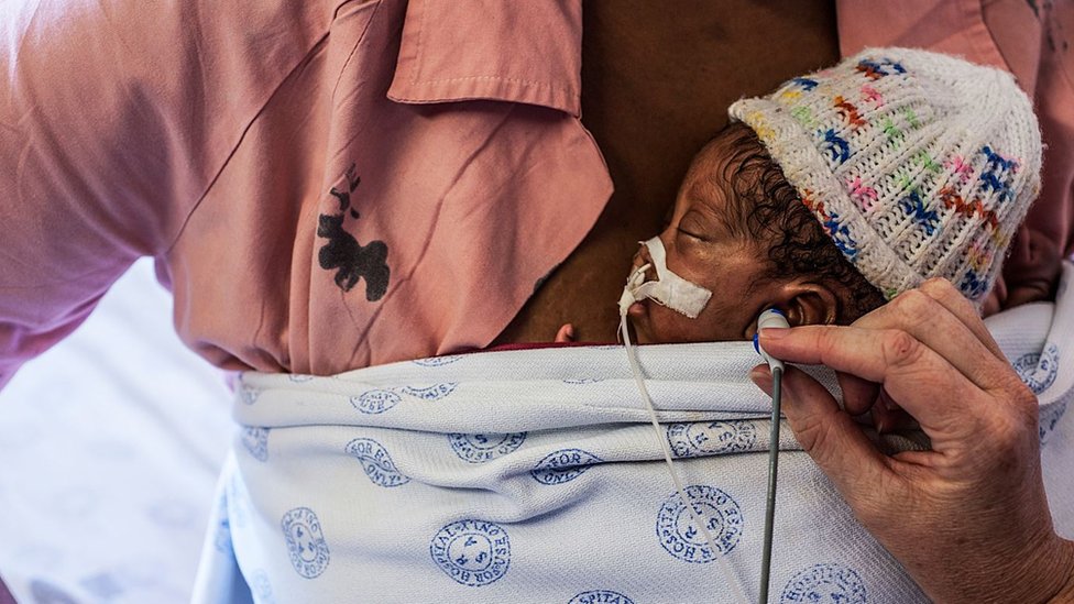 "kangaroo mother", holds her son against her skin while