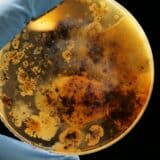 Ove dve bakterije su najsmrtonosnije i vodeći su uzrok smrtnosti, odmah posle srca 4