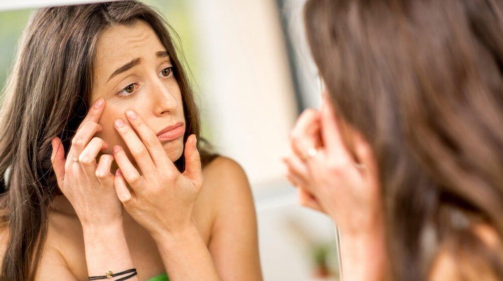 Šta ceđenje bubuljica čini vašoj koži? 1