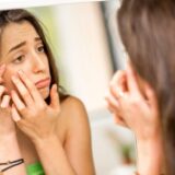 Šta ceđenje bubuljica čini vašoj koži? 8