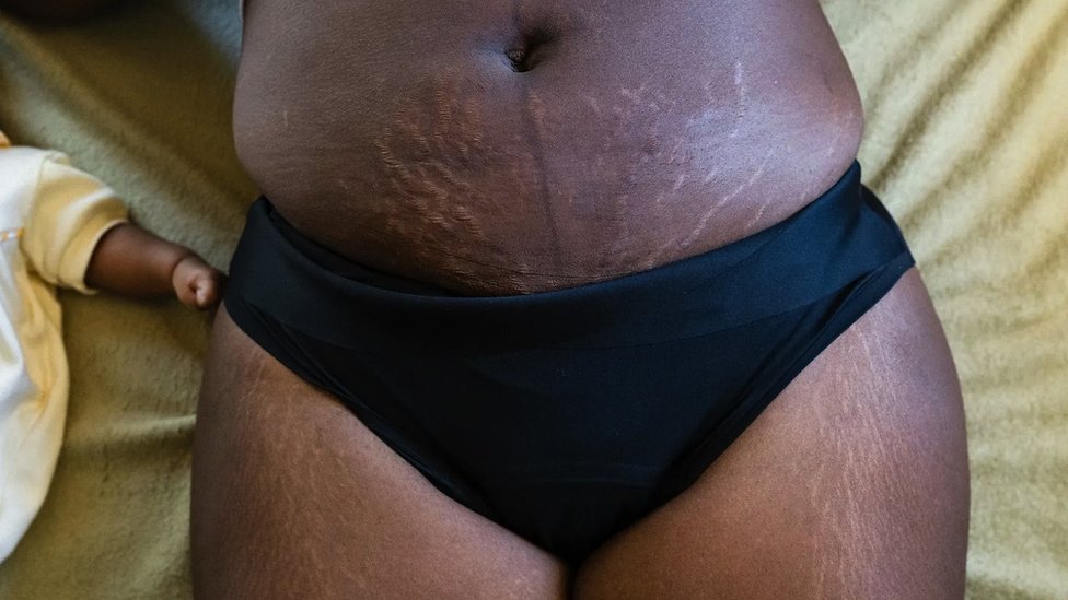 Roditeljstvo, porođaj i kilaža: Zašto se od novih majki očekuje da se brzo „vrate na staru liniju“ 2 Porođaj, mame, kilaža