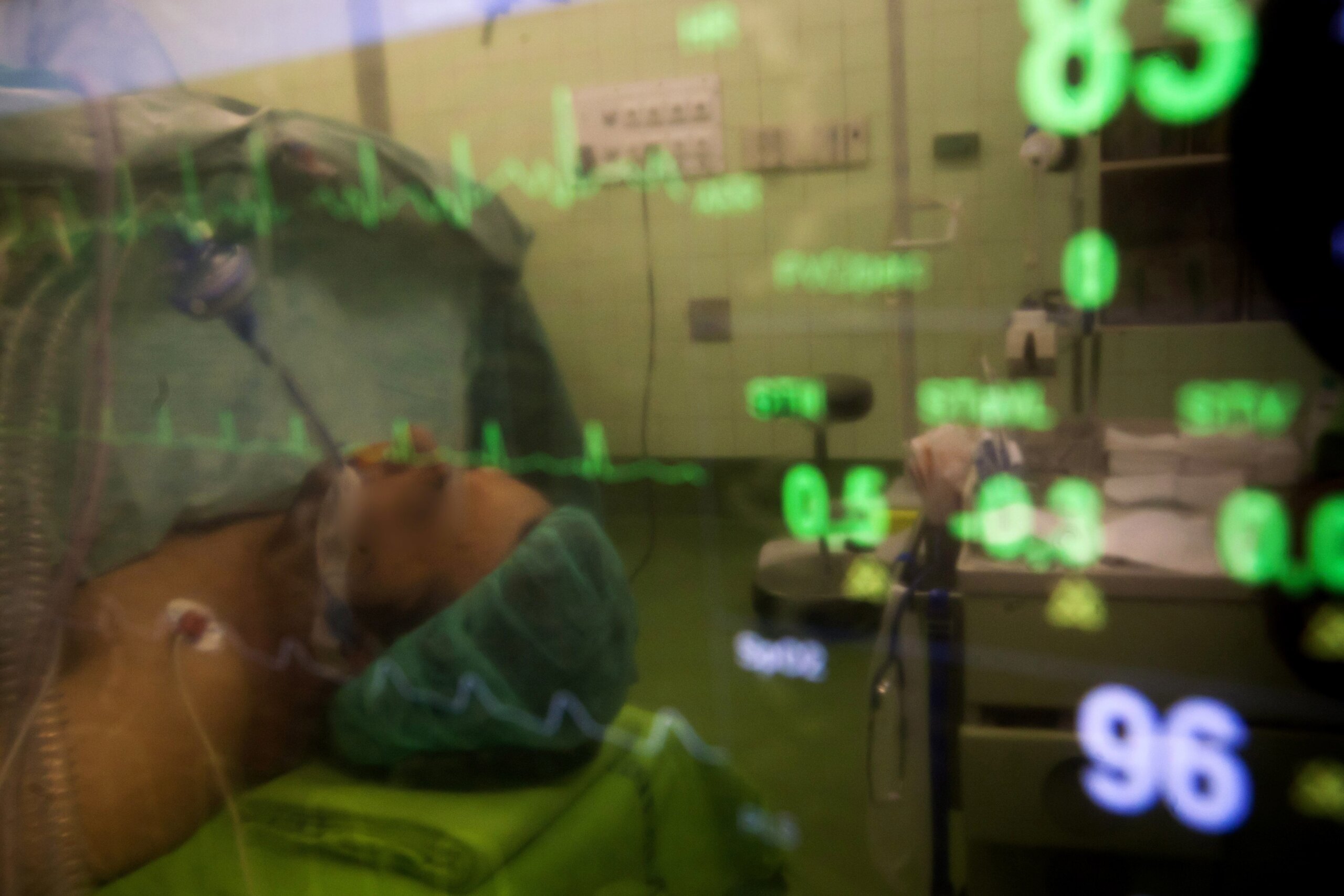 Kako je doniranje organa regulisano u regionu? 2 Kako je doniranje organa regulisano u regionu? 2