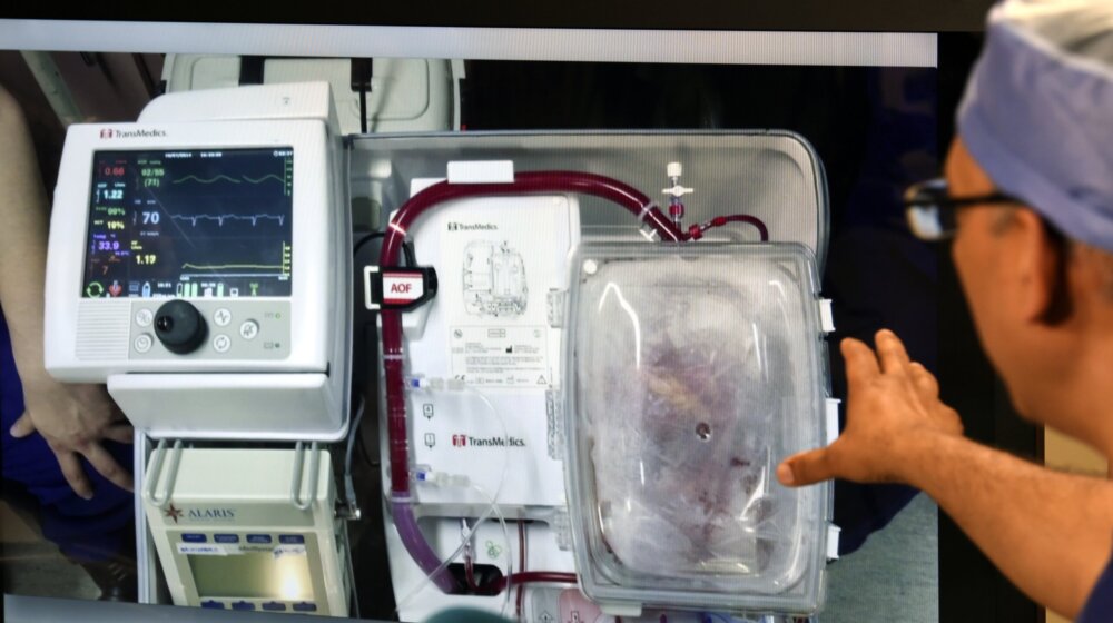 Kako je doniranje organa regulisano u regionu? 1