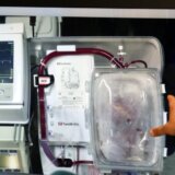 Kako je doniranje organa regulisano u regionu? 4