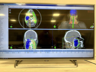 U Univerzitetskom kliničkom centru Niš danas počinje da radi četvrti aparat za zračnu terapiju 6