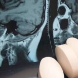 Zdravlje i medicina: Lekovi koji menjaju ono što smo 4