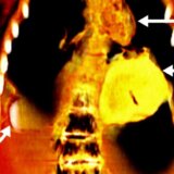 Arheologija: „Zlatni dečak“ - mumija sahranjena sa „zlatnim srcem“ pre 2.300 godina u starom Egiptu 2