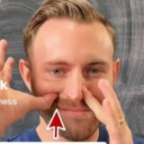 Kiropraktičar pokazao kako da otpušite nos bez kapi: Treba vam manje od pola minuta (VIDEO) 7