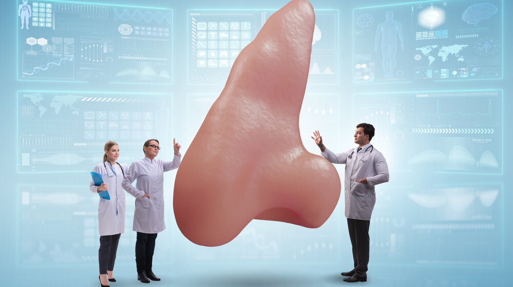 Kome je sve potrebna estetska korekcija nosa? 1