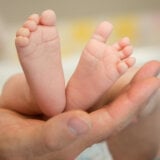 Majka rodila bebu koja se rađa jednom u 625 miliona slučajeva 11