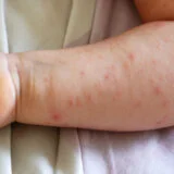 Životi dece vise o koncu 3