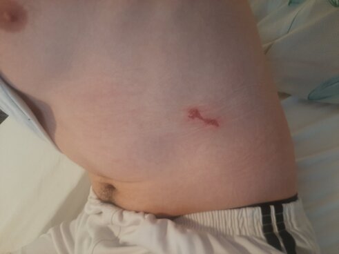 Povređeni Stefan Tomić Još jedan srpski mladić napadnut noćas na KiM dok se vraćao sa bratom s ponoćne Božićne liturgije (FOTO) 4