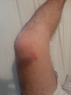 Povređeni Stefan Tomić Još jedan srpski mladić napadnut noćas na KiM dok se vraćao sa bratom s ponoćne Božićne liturgije (FOTO) 2