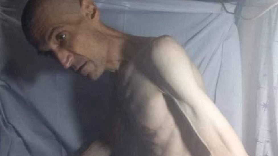 Photo released on 2 February 2023 purportedly showing emaciated jailed Iranian dissident Farhad Meysami