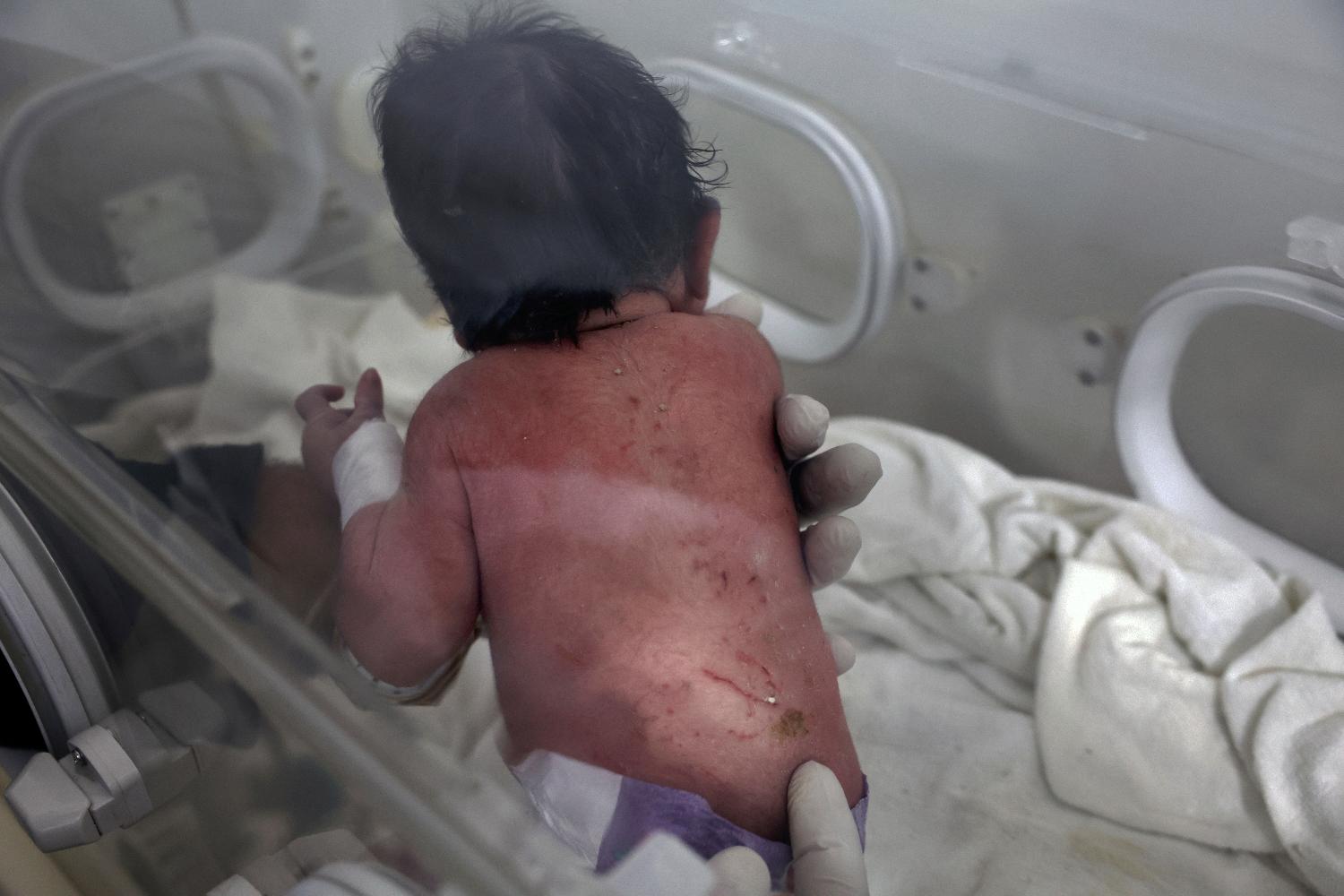 Ovo je beba rođena pod ruševinama u Siriji, cela porodica stradala u zemljotresu (FOTO) 2