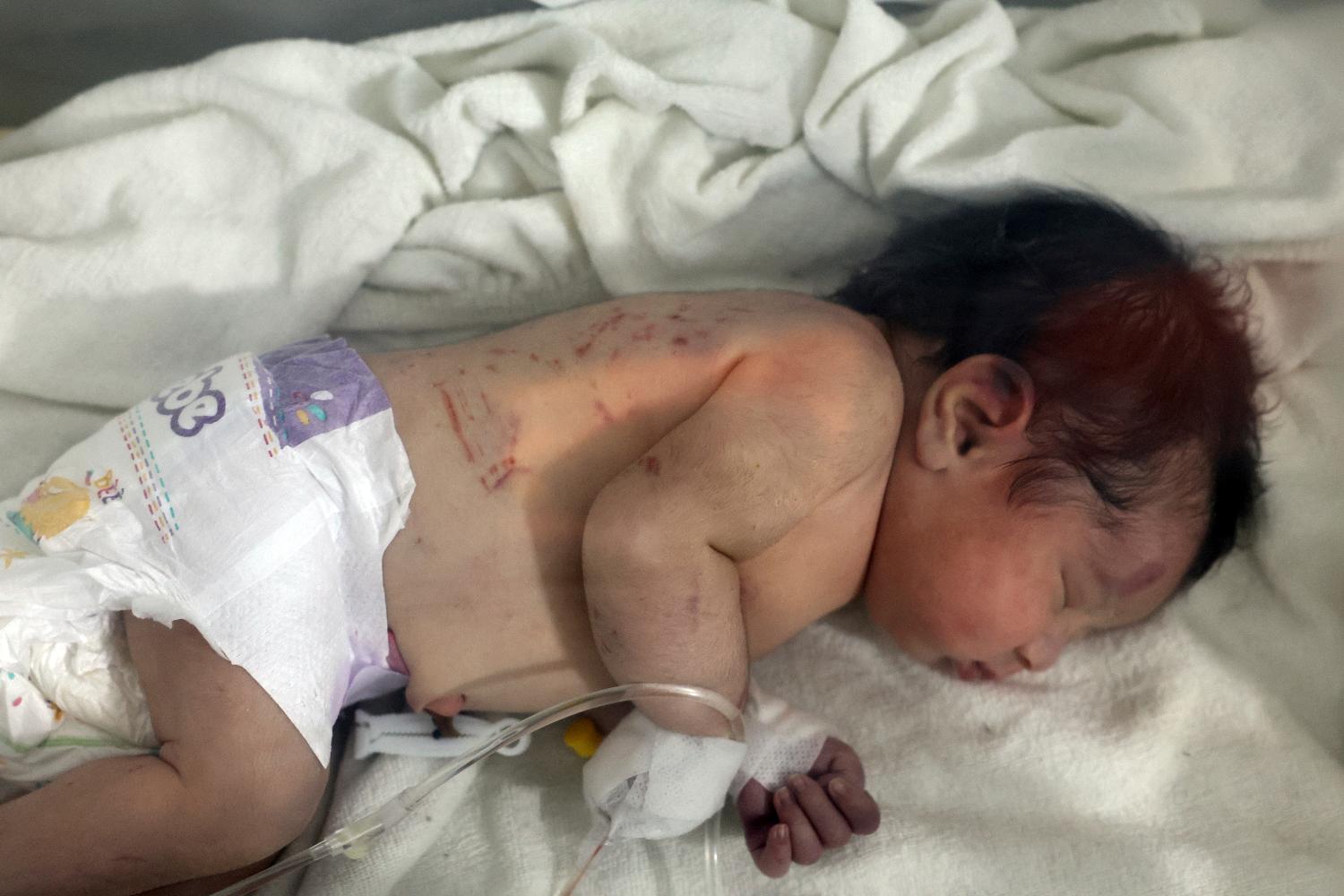 Ovo je beba rođena pod ruševinama u Siriji, cela porodica stradala u zemljotresu (FOTO) 3