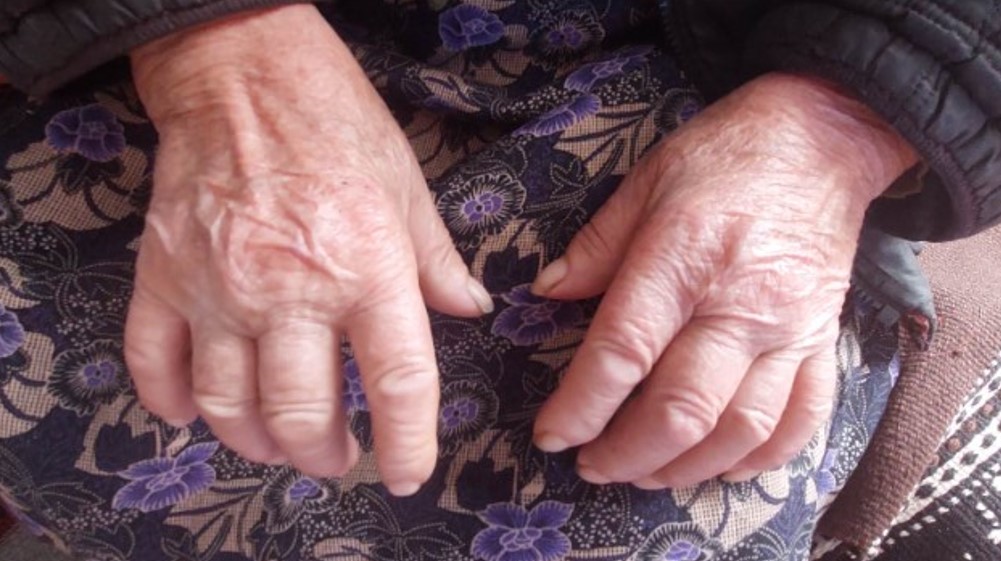 “Molim boga da umrem da se smirim, ne mogu više ovako”: Muke baka Perse iz sela pored Zaječara 2 “Molim boga da umrem da se smirim, ne mogu više ovako”: Muke baka Perse iz sela pored Zaječara 2