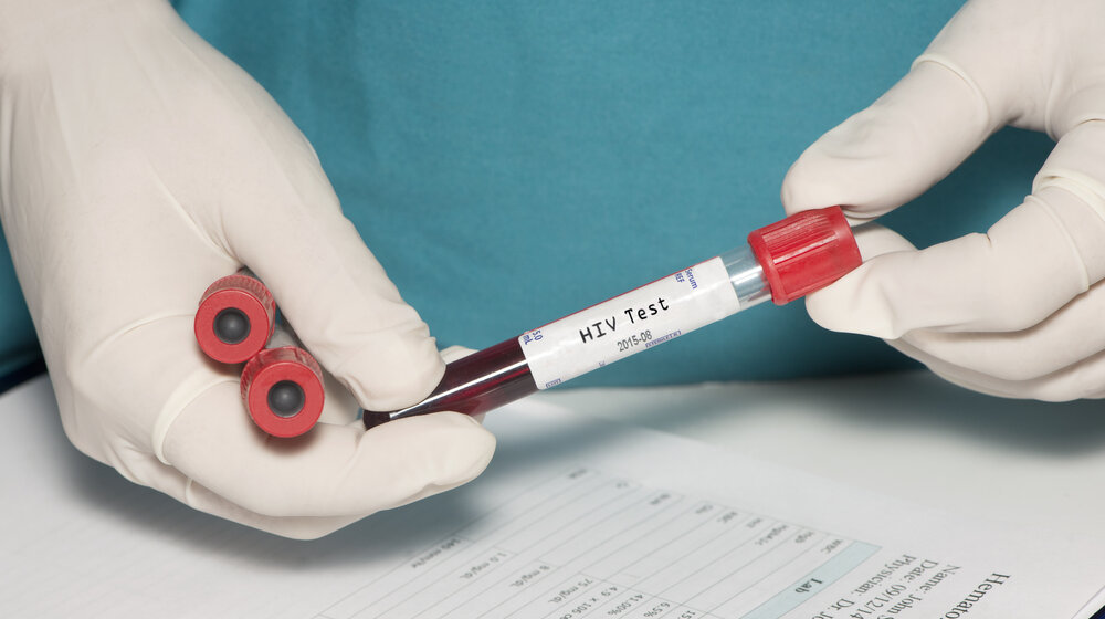 „Pacijent iz Diseldorfa“ izlečen od HIV-a nakon transplatacije matičnih ćelija? 1