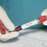„Pacijent iz Diseldorfa“ izlečen od HIV-a nakon transplatacije matičnih ćelija? 5