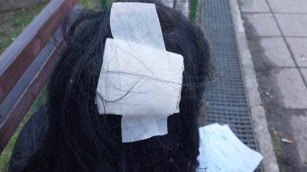 “Tresla sam se od straha, još uvek sam u šoku”: Ispovest Tamare iz Bora koju su izujedali psi 2