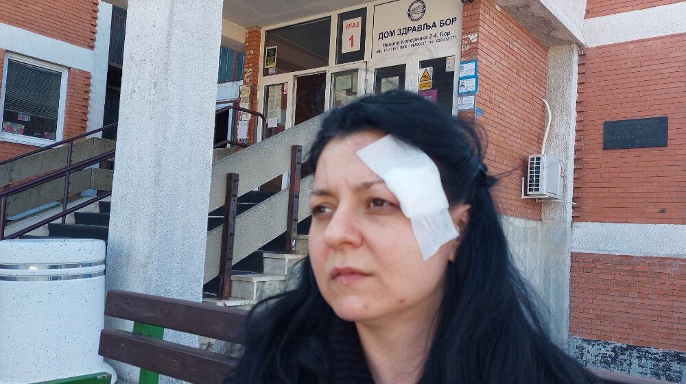 “Tresla sam se od straha, još uvek sam u šoku”: Ispovest Tamare iz Bora koju su izujedali psi 1