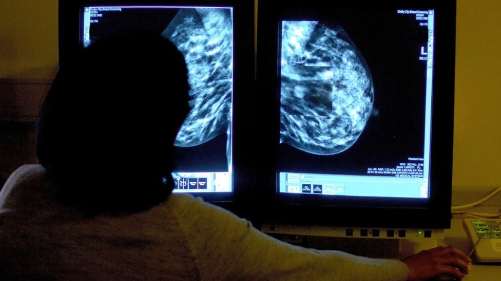 Zdravlje: Zašto savremena medicina zanemaruje transrodne osobe 4 Zbog načina na koji se nudi pregled raka, transrodni muškarci će često propustiti vitalne preglede koji mogu otkriti znake raka dojke