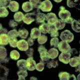 Amerika i zdravlje: Stanovnik Floride preminuo od amebe koja izjeda mozak 5