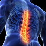 Zdravlje: Pet stvari koje treba da znate o bolovima u leđima 12