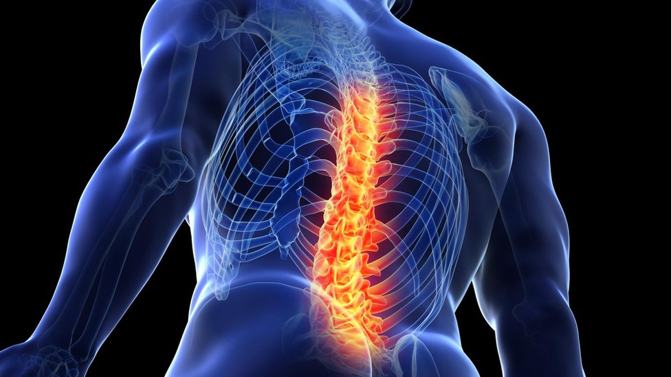 bol u leđima, leđa