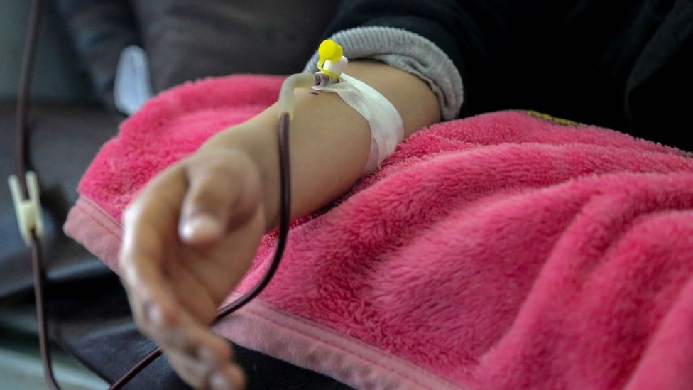 Srbija i zdravlje: Život sa hemofilijom i kako bi „najskuplji lek na svetu“ mogao da ga promeni 2 Intravenska terapija