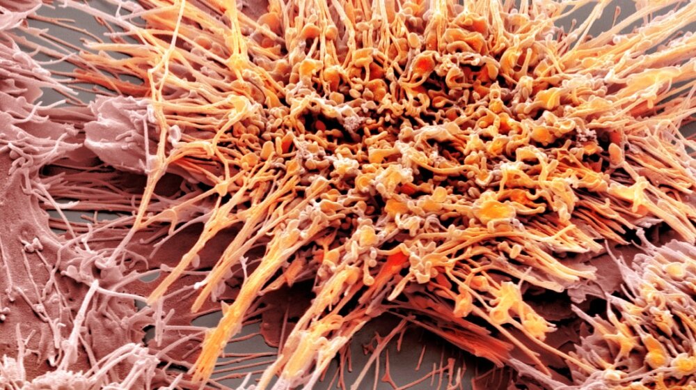 Istraživanje koje je zaprepastilo naučnike: Otkrivene nove sposobnosti ćelija raka 1