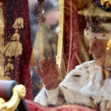 Mnogi su komentarisali šake kralja Čarlsa III na krunidbi, a doktor je sada objasnio zašto su mu prsti natečeni 12