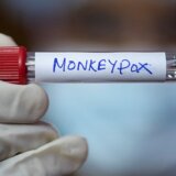 Majmunske boginje: Svetska zdravstvena organizacija proglasila kraj epidemije 6