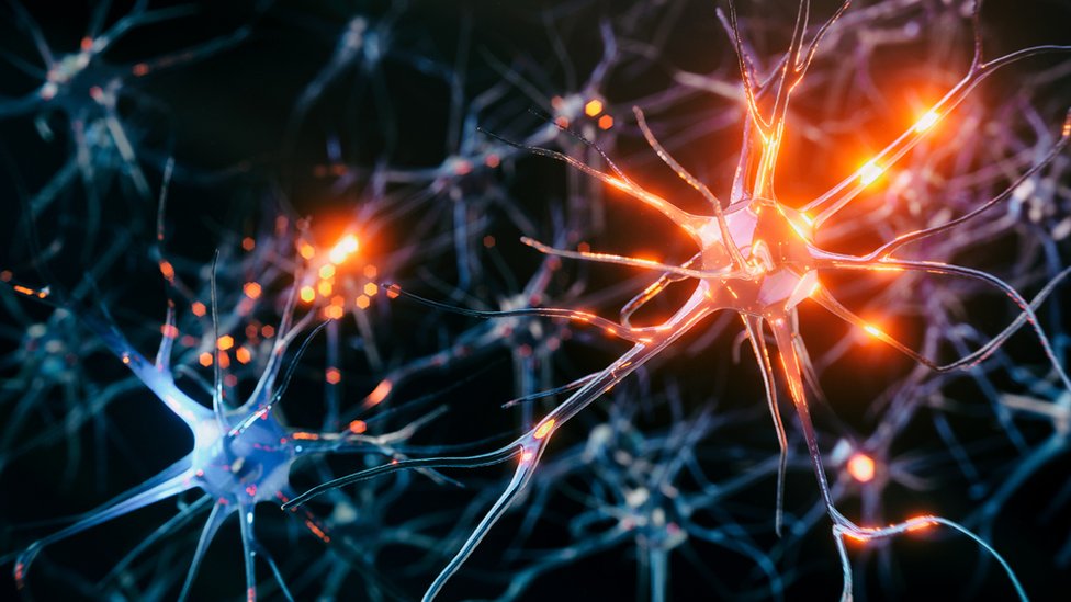 Parkinsonova bolest: Novo istraživanje moglo bi da otkrije rane uzroke 1 Brain cells