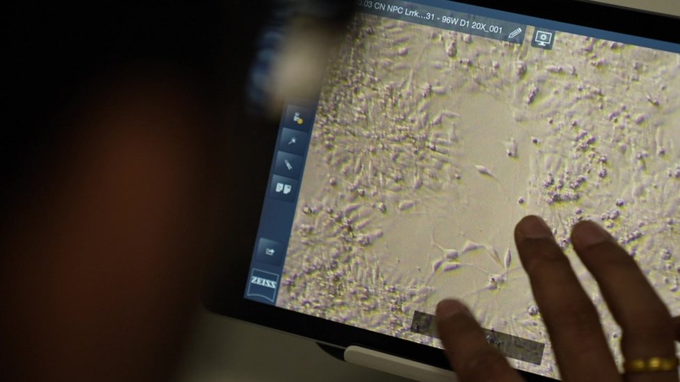 Parkinsonova bolest: Novo istraživanje moglo bi da otkrije rane uzroke 2 Scientists looking at neurons