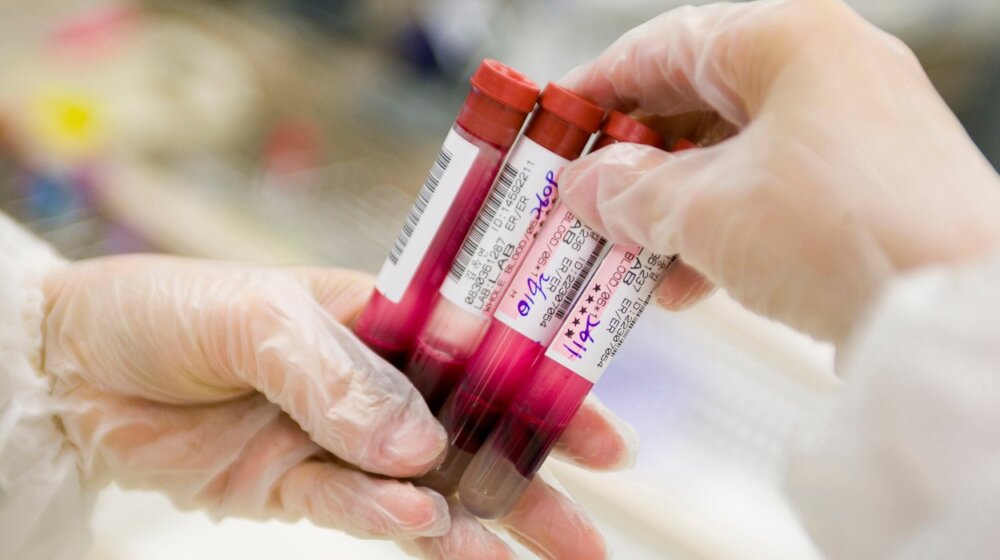 Tumačenje krvne slike za početnike: Vodič kroz skraćenice i normalne referentne vrednosti 1