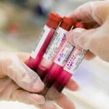 Tumačenje krvne slike za početnike: Vodič kroz skraćenice i normalne referentne vrednosti 9