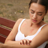 Ova odeća privlači komarce 12