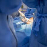 Australijski lekari u mozgu žene našli crva od osam santimetara 7