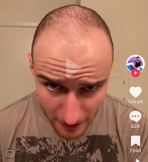 Ruzmarinova voda je hit na TikToku, kažu da je spas od ćelavosti: Ovo je recept, pravi se lako 1